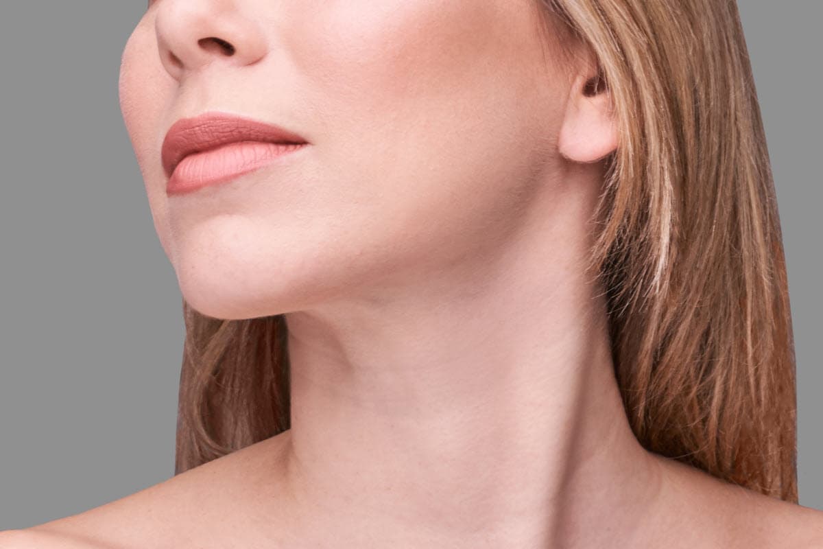 What is a chin implant?