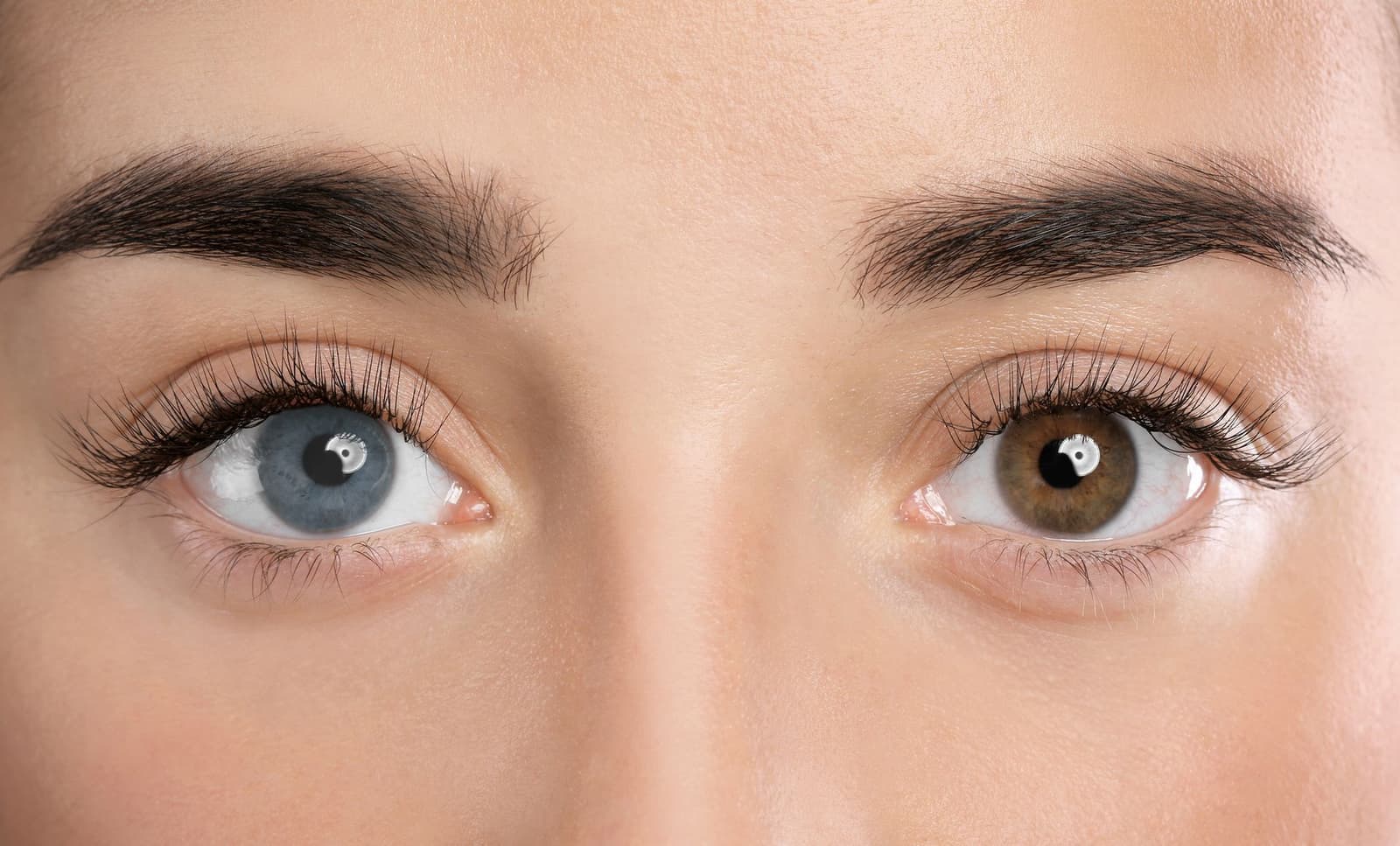 Procedures to change eye color