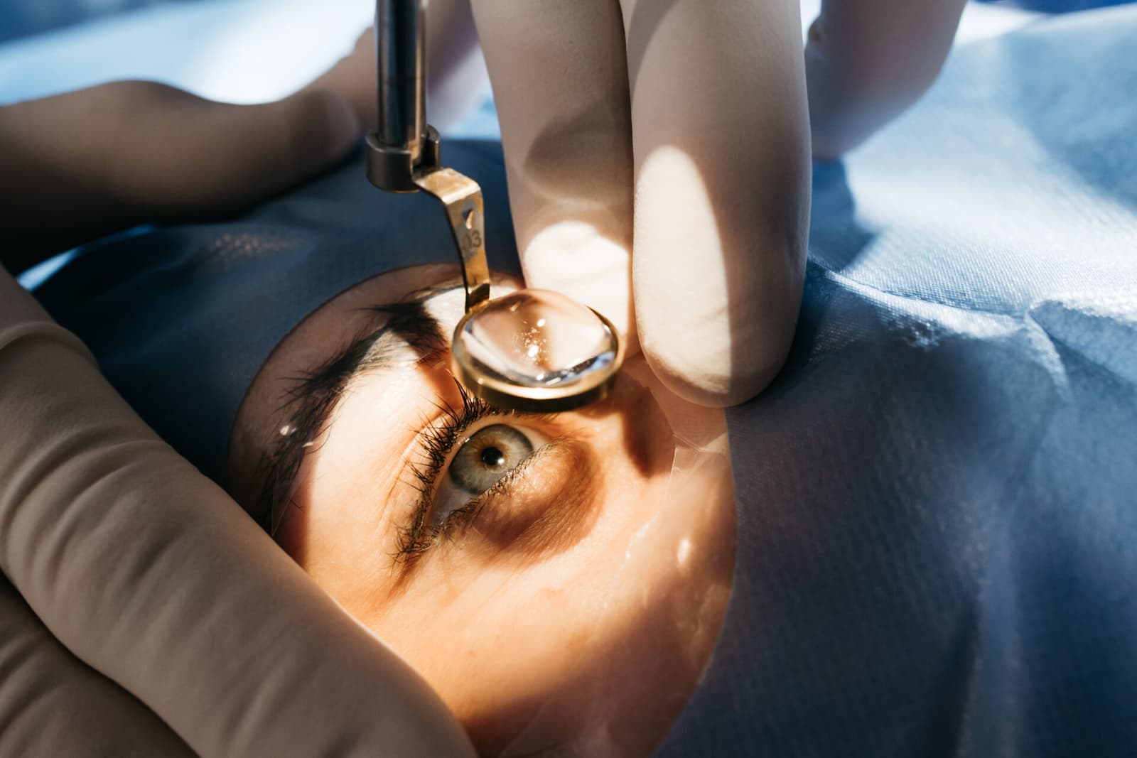 What are the dangers of eye color change surgery?