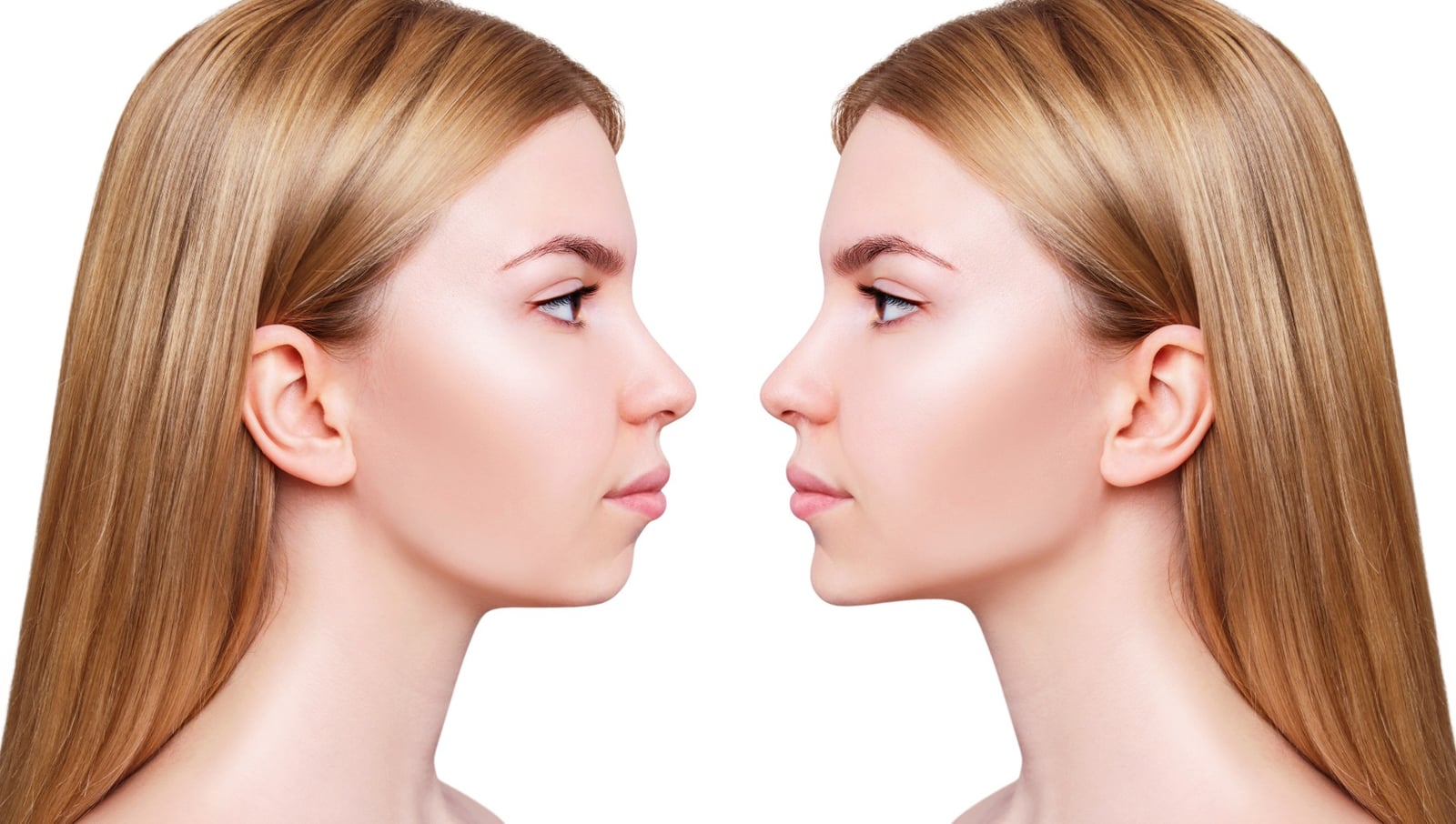 What is Orthognathic Surgery?