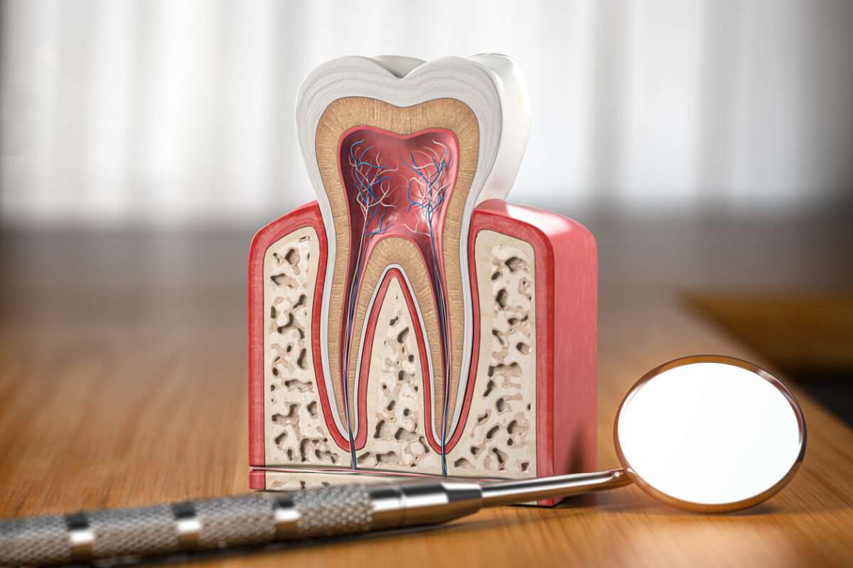 What are the types of Periodontal Disease?