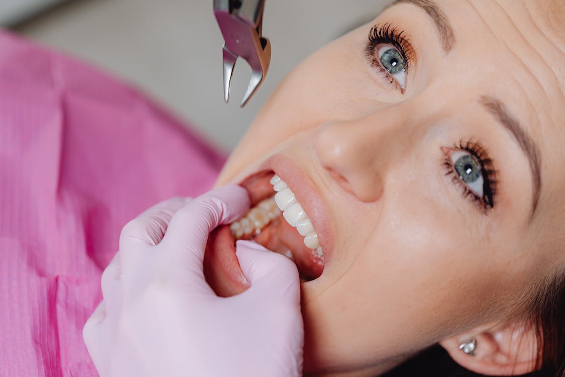Do's & Don'ts After a Tooth Extraction