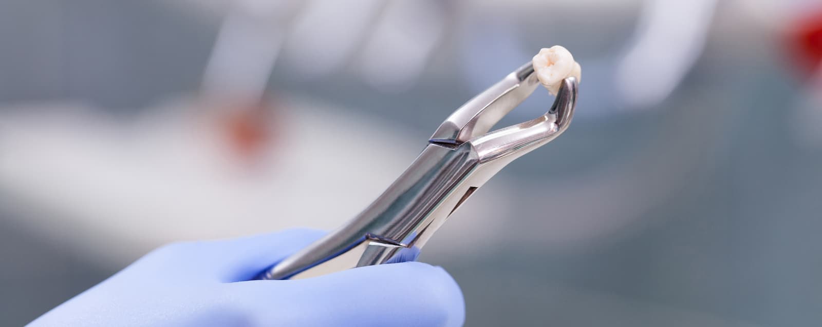 How does a tooth extraction heal?