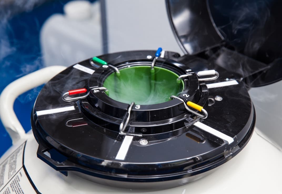 What is sperm donation?