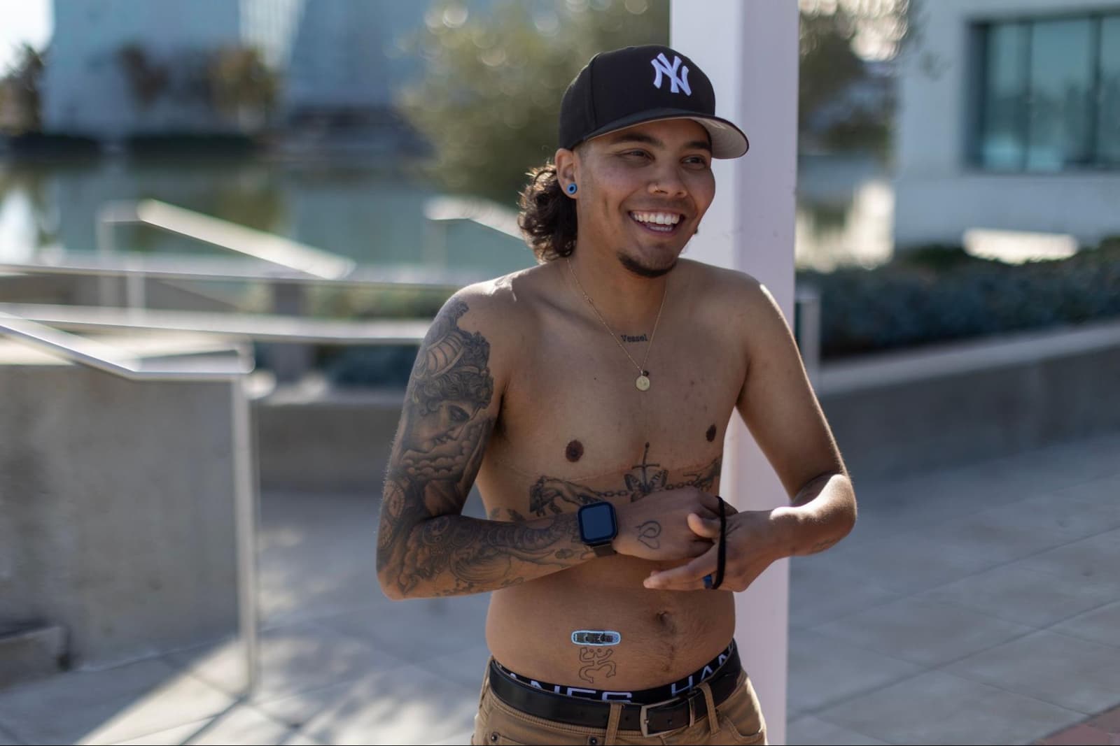 Female to male (FTM) procedures