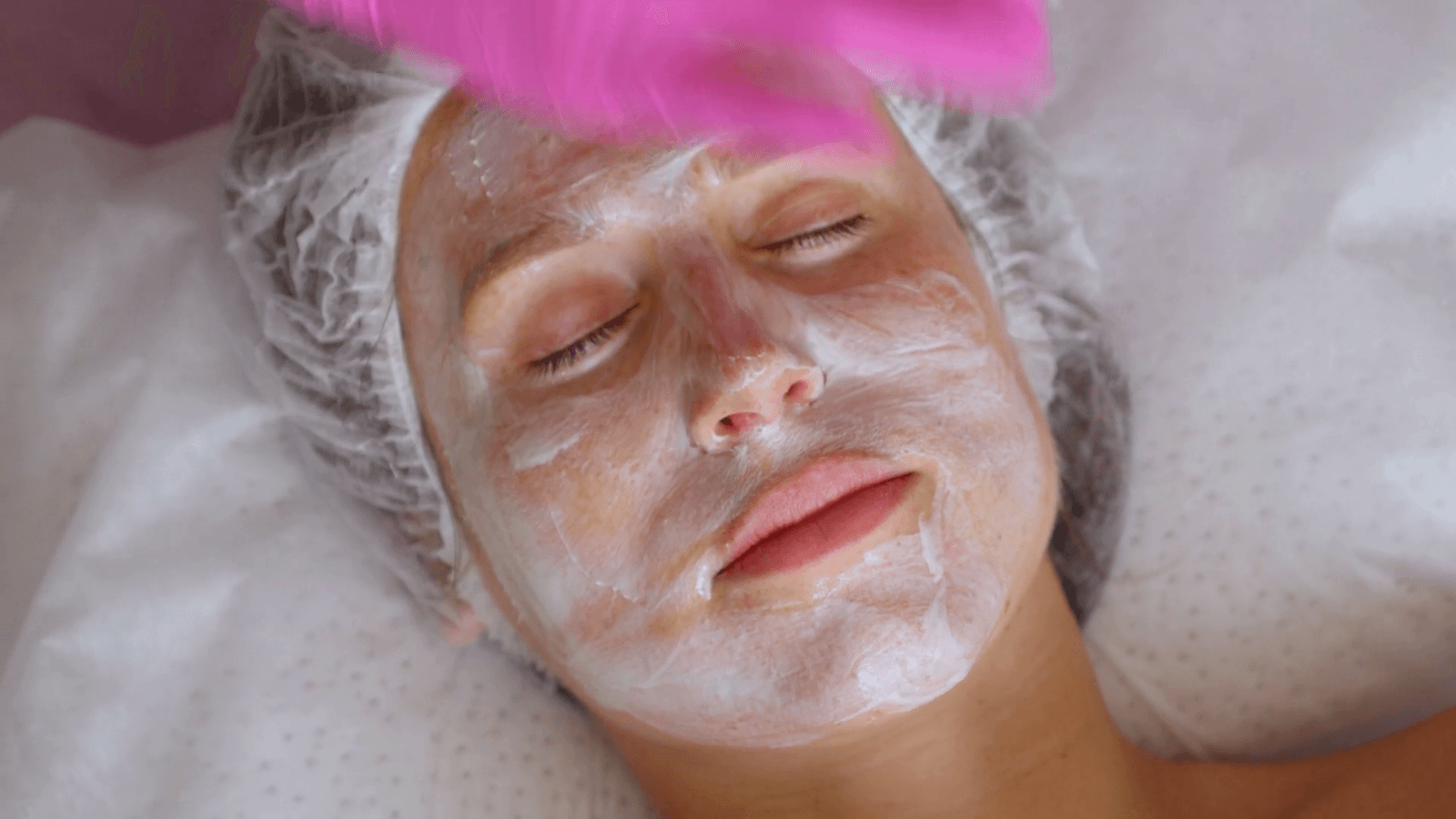 Different depths of chemical peel