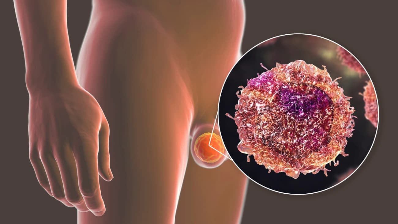 Orchiectomy recovery process