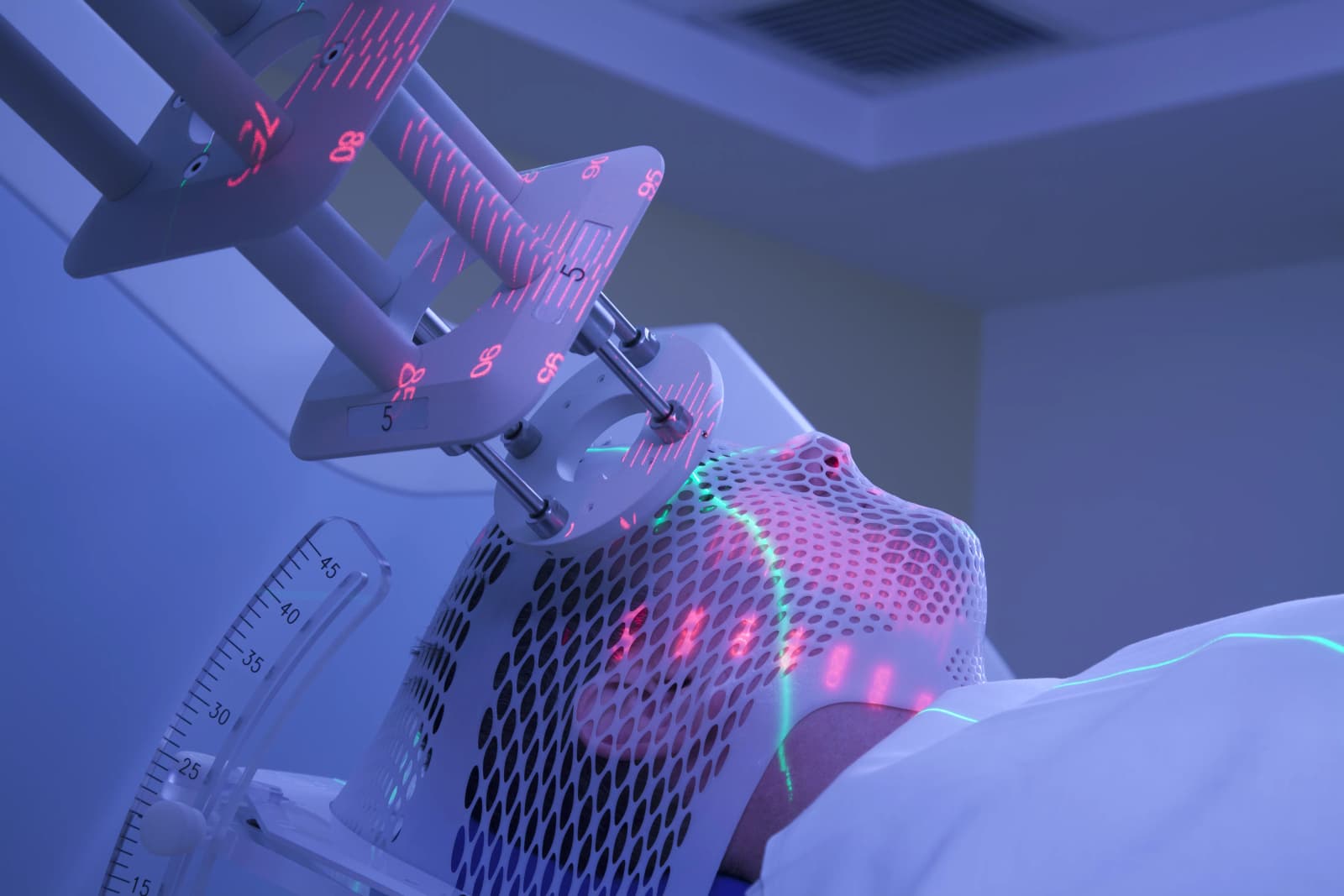 What are the advantages of radiation therapy?