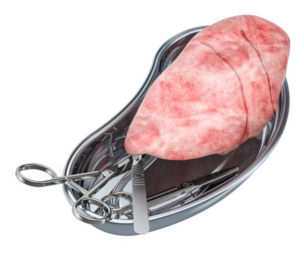 What does lung transplant treat?