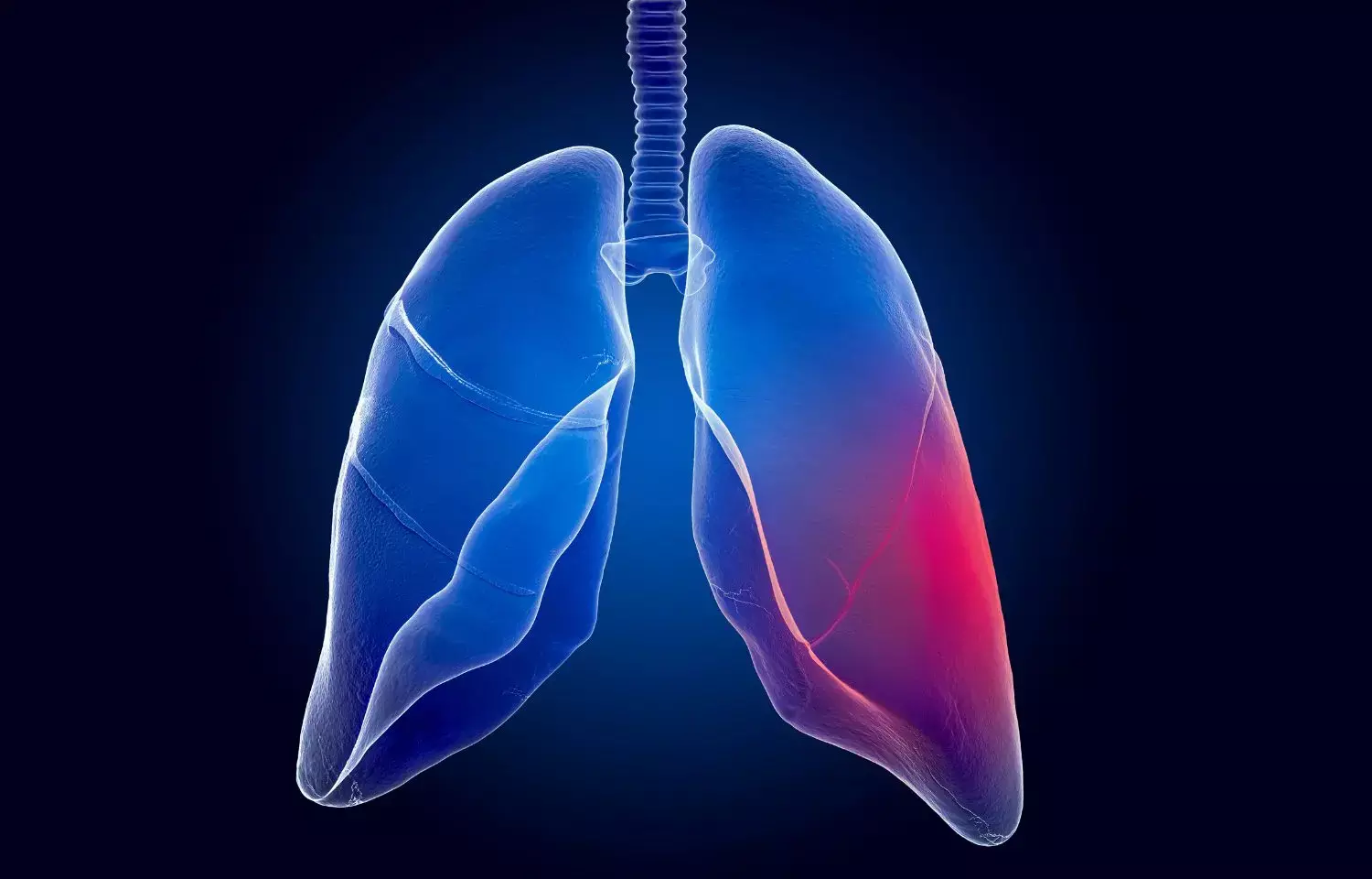 Who qualifies for lung volume reduction?