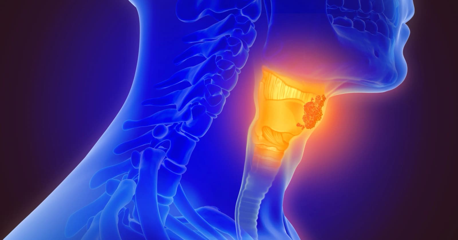 Can you talk after a laryngectomy?