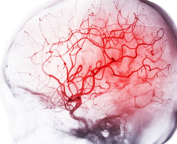 What is Angiography?