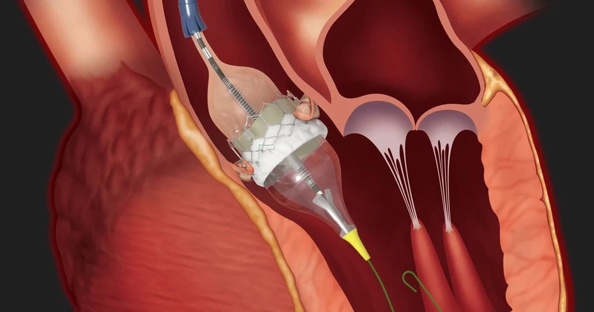 What are the warning signs of arrhythmia?