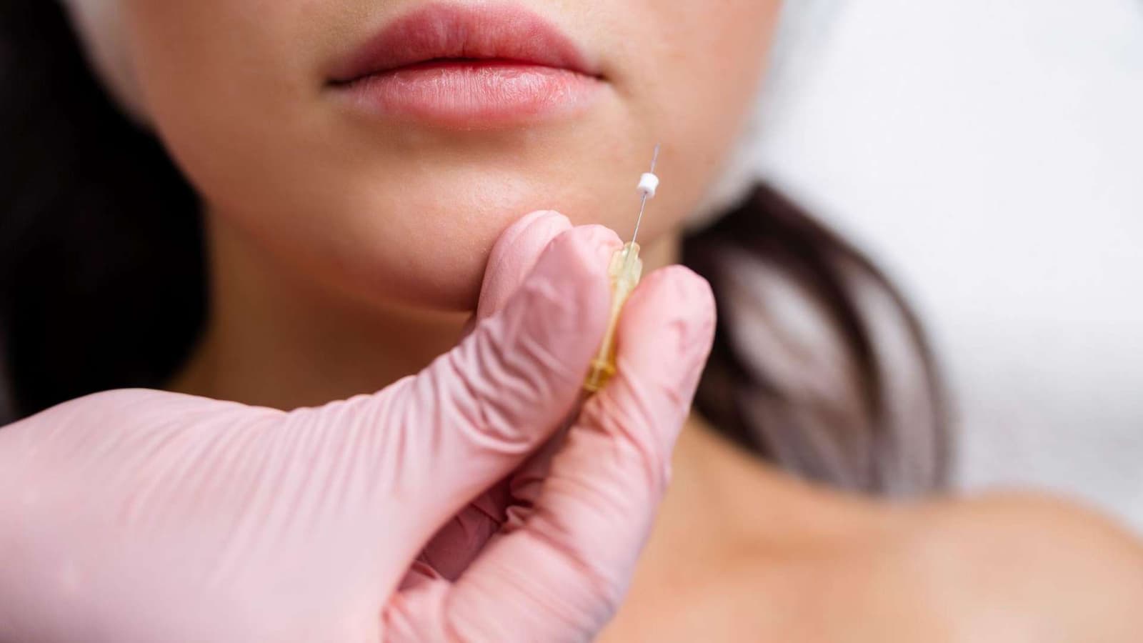 Thread lift recovery process