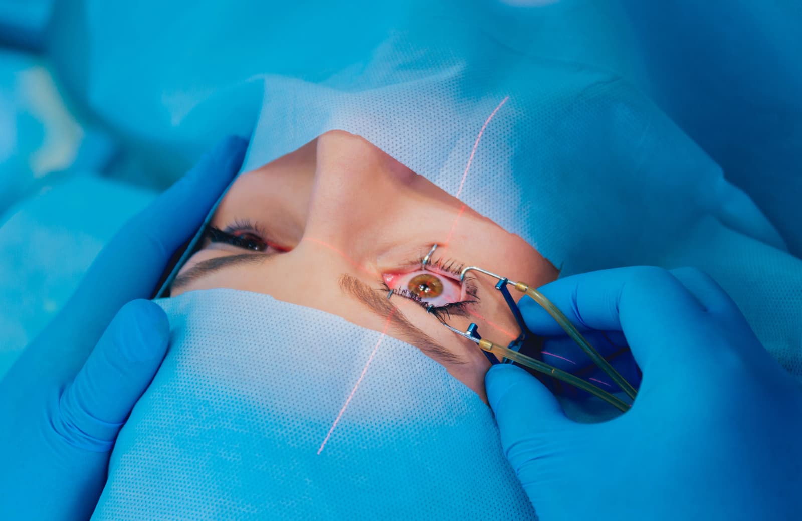 What are the different types of cornea transplant surgeries?