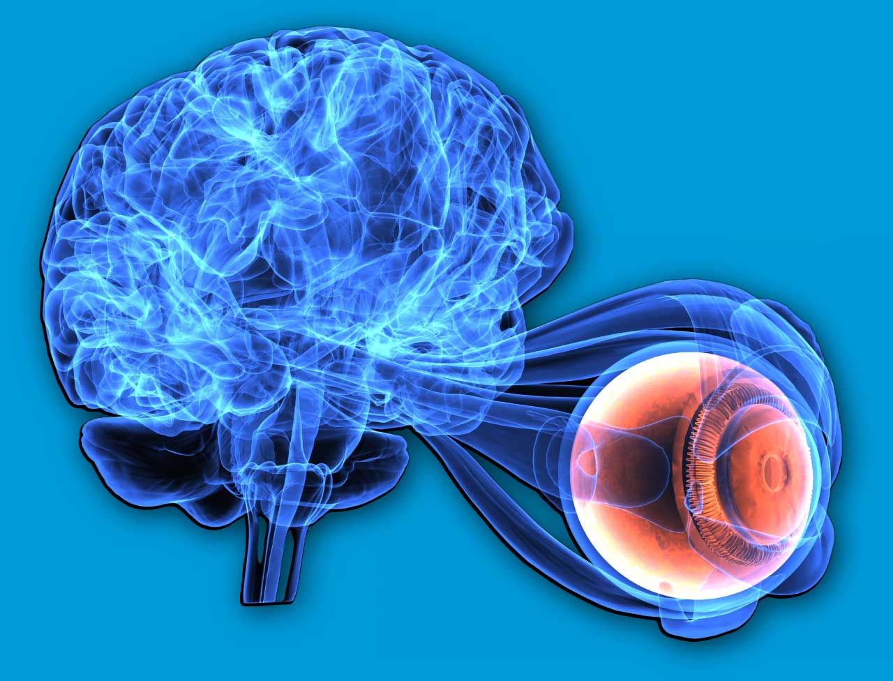 What are neuro-ophthalmic Conditions?