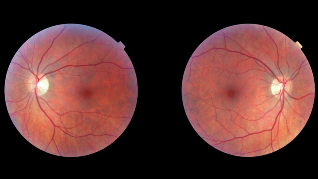 What causes neuro-ophthalmic conditions?