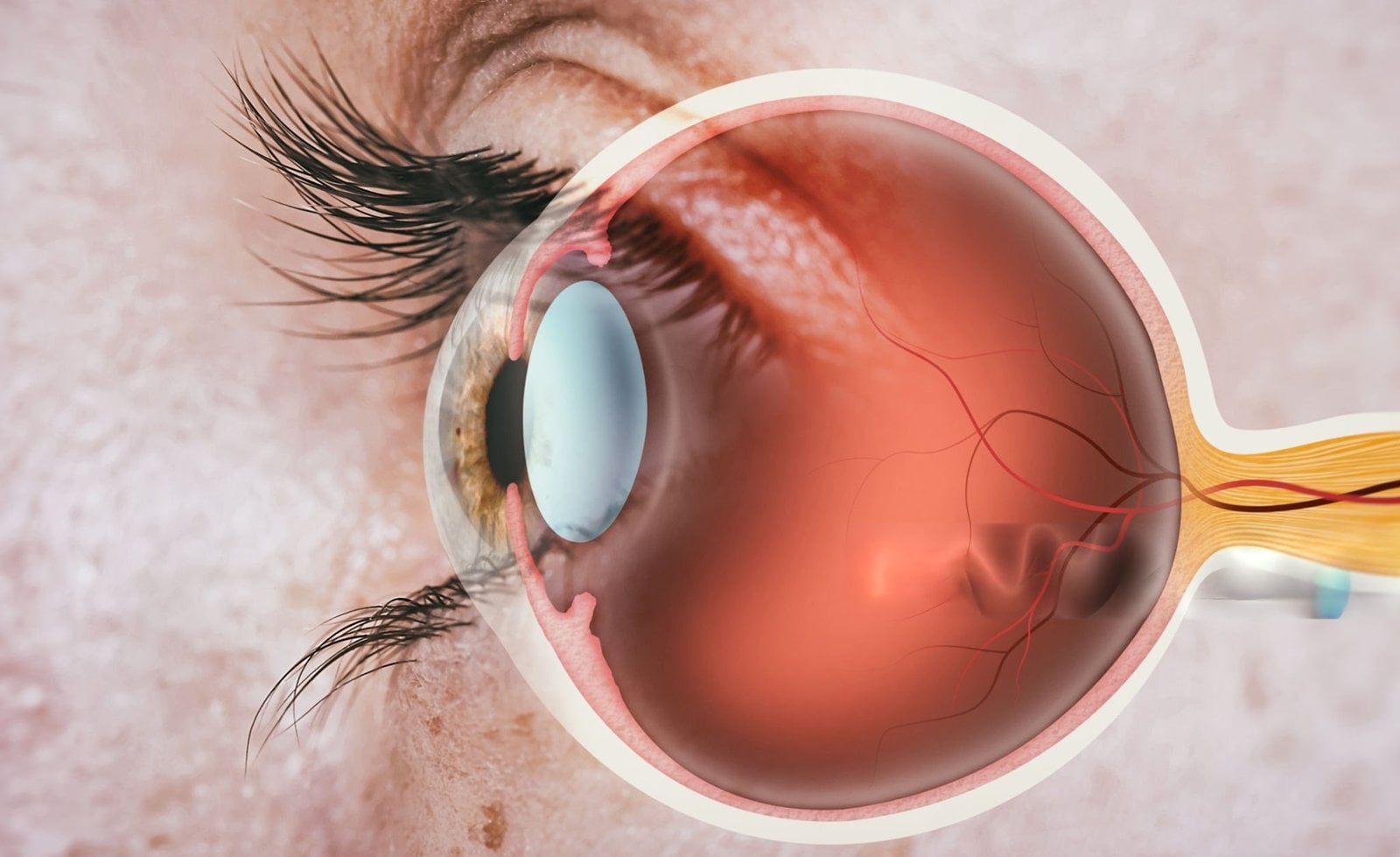 What are the different types of retina surgery?