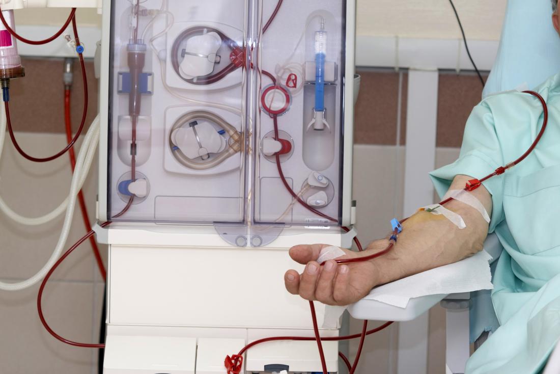 What Are the 4 Types of Dialysis?