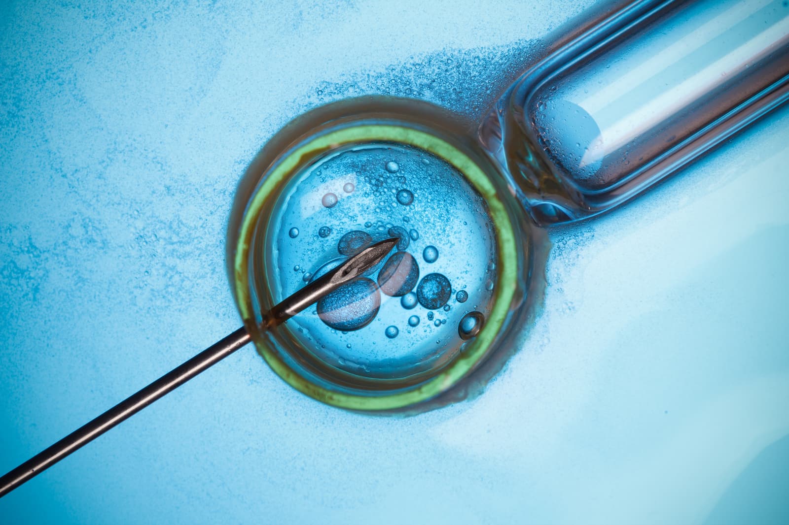 Key Differences between ICSI and IVF