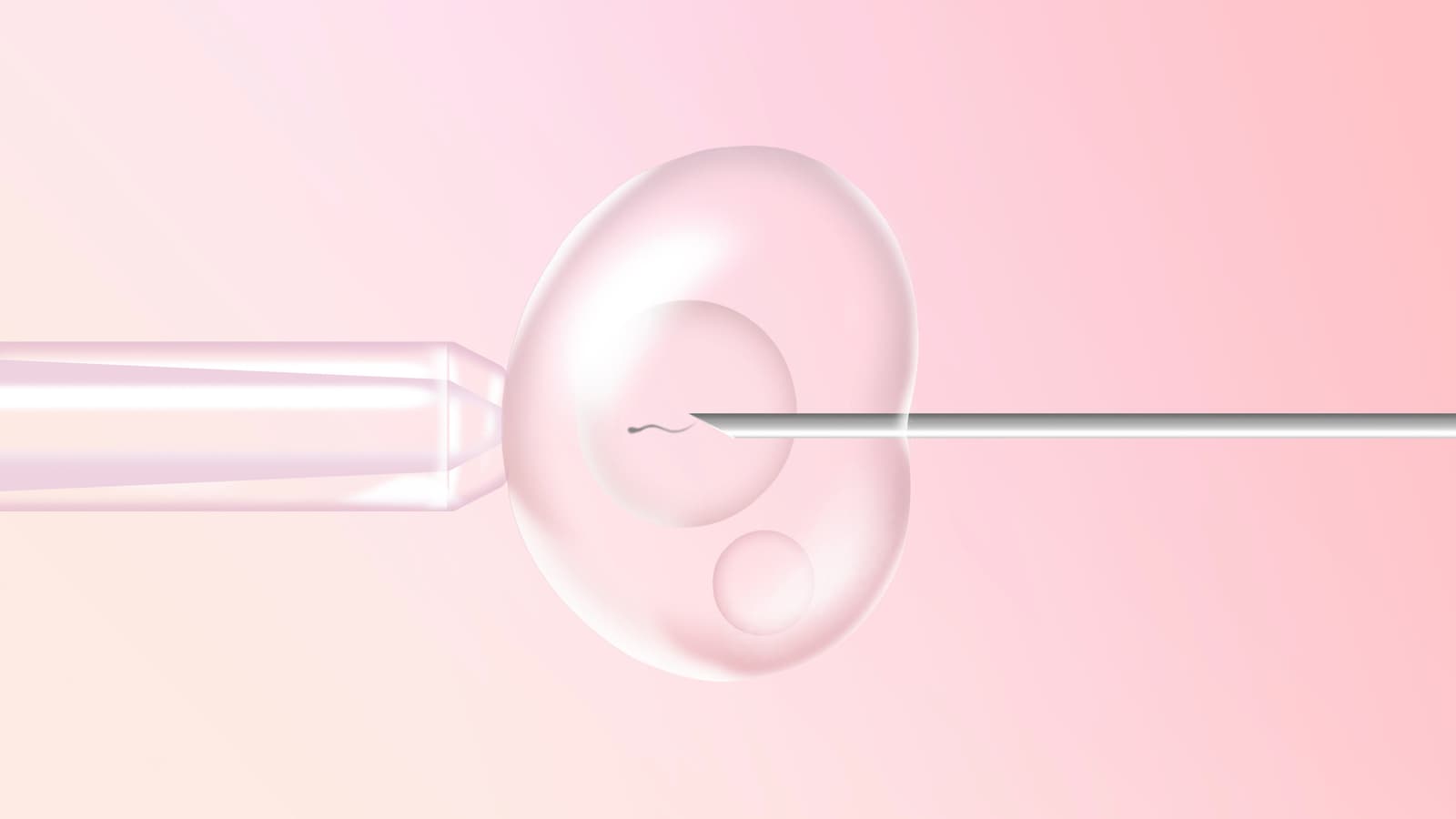 Which Treatment Is Right for You?