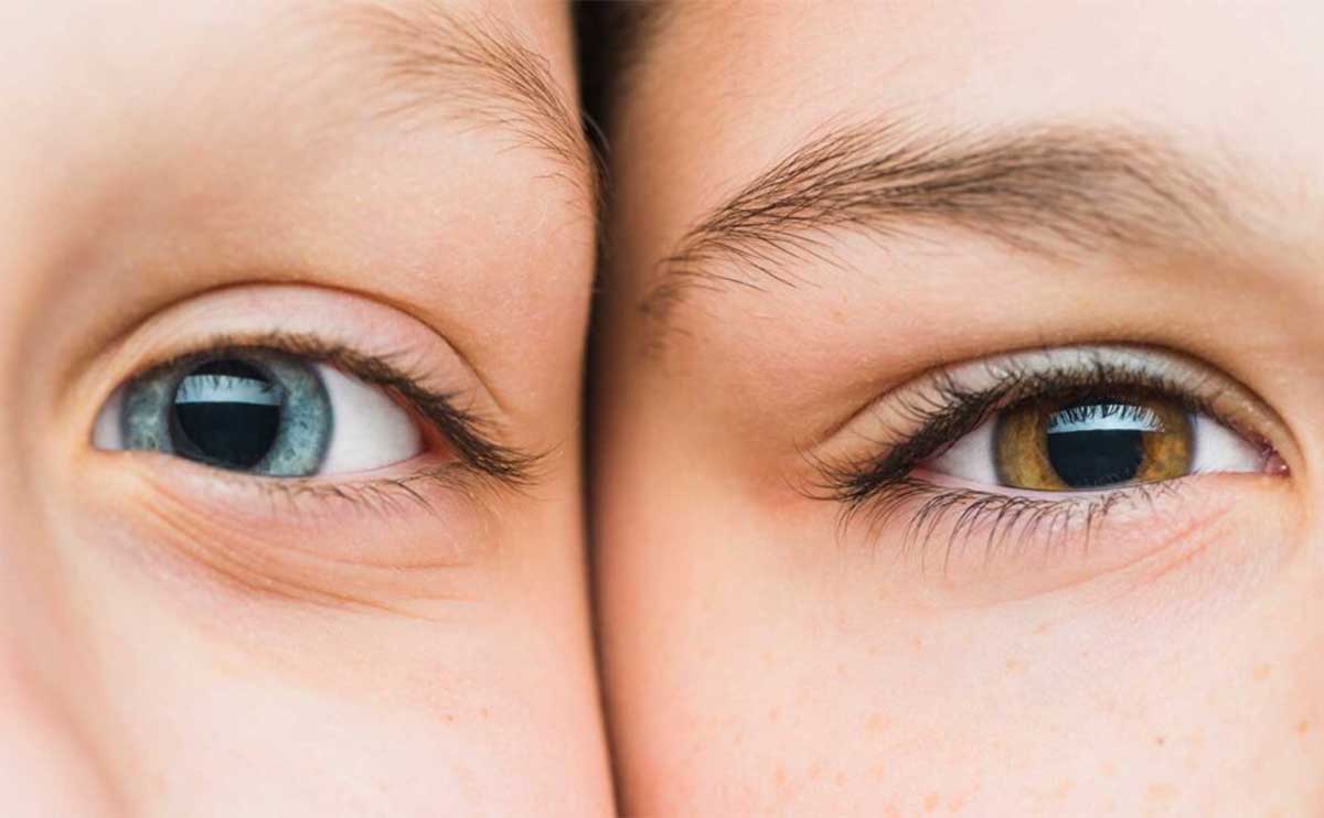 Understanding Natural Eye Color