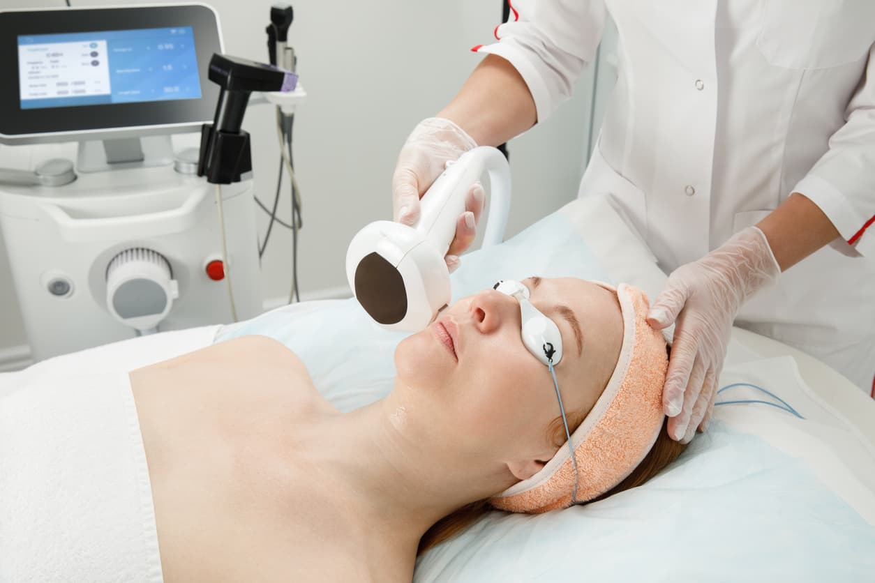 Skin Laser Resurfacing