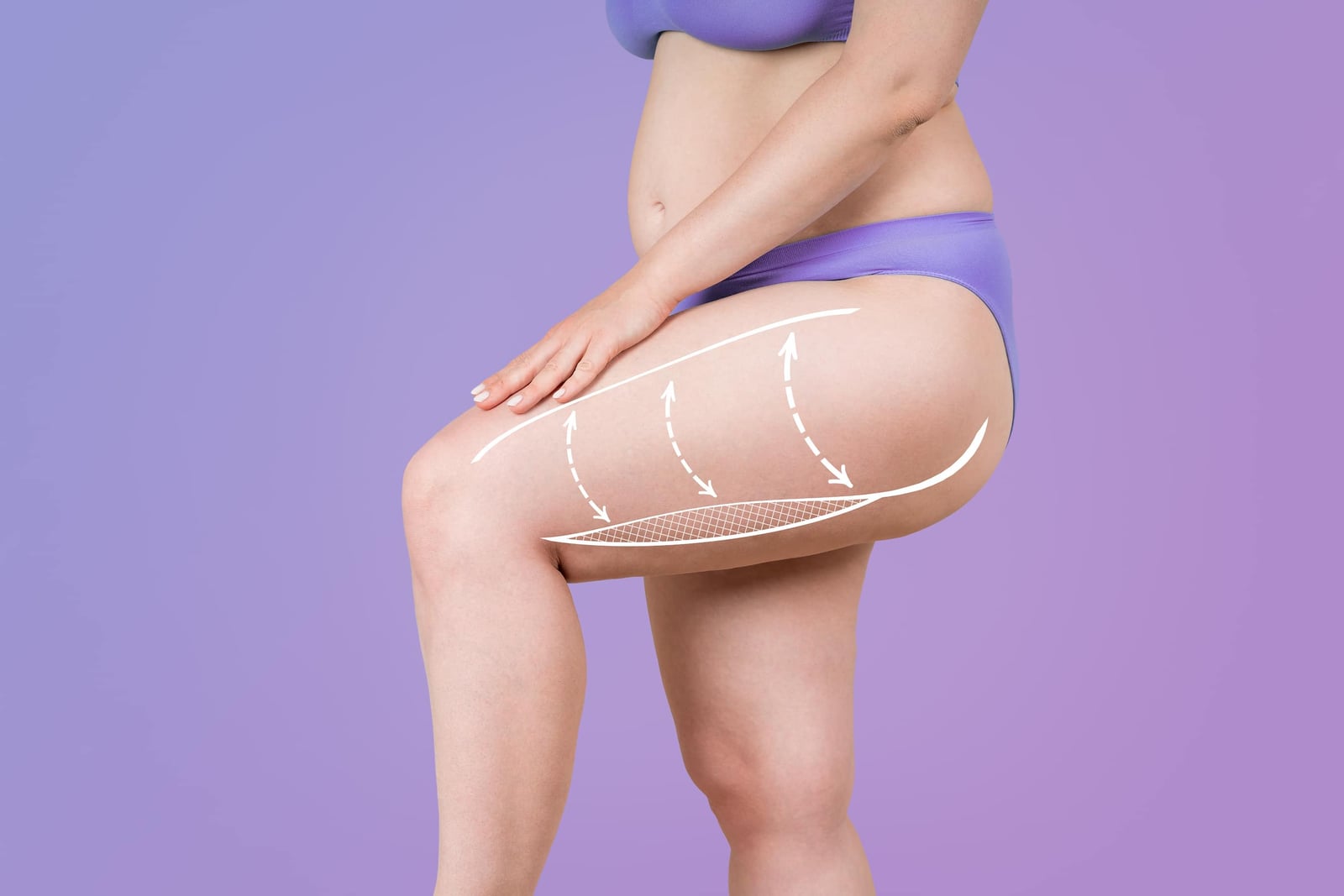 What are the different types of Thigh Lift procedures?