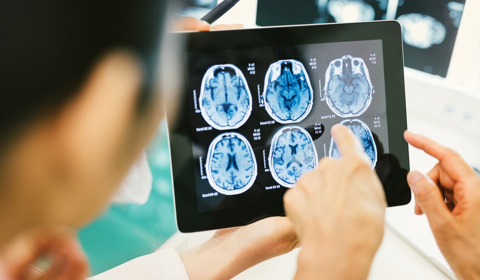 What is Radiation in Medical Imaging?