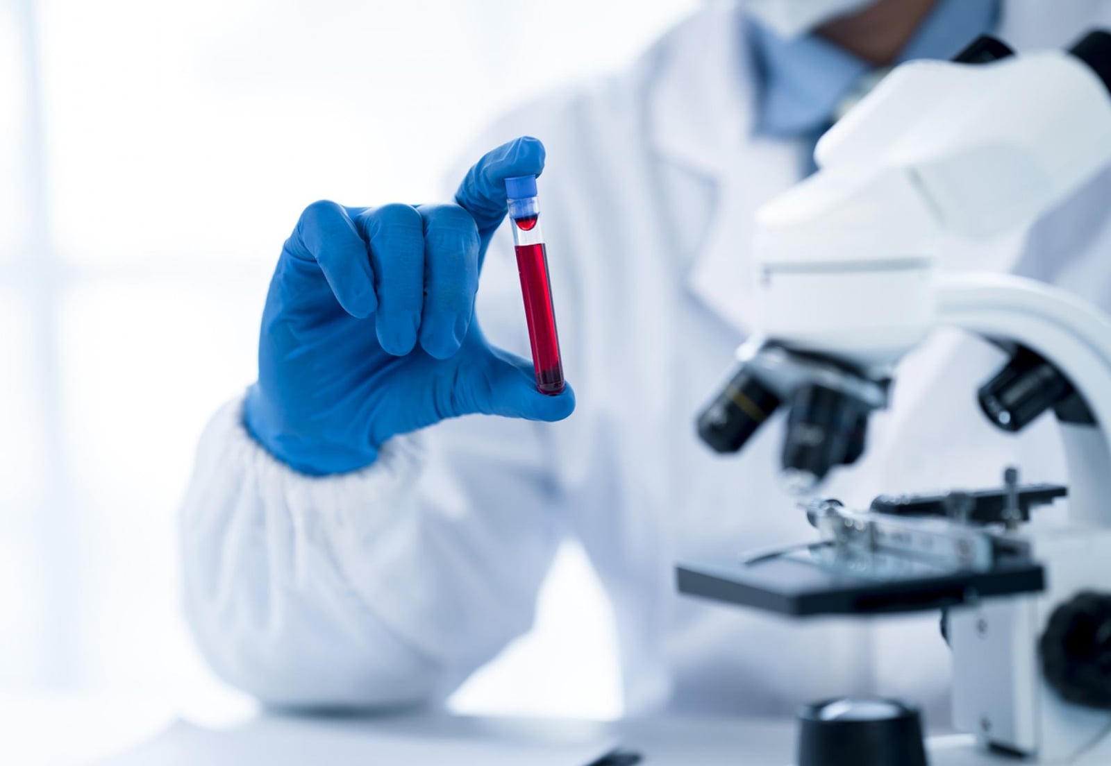 What You Need to Know About Blood Testing