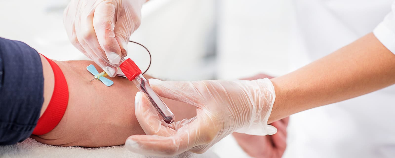 What Is a Blood Test?