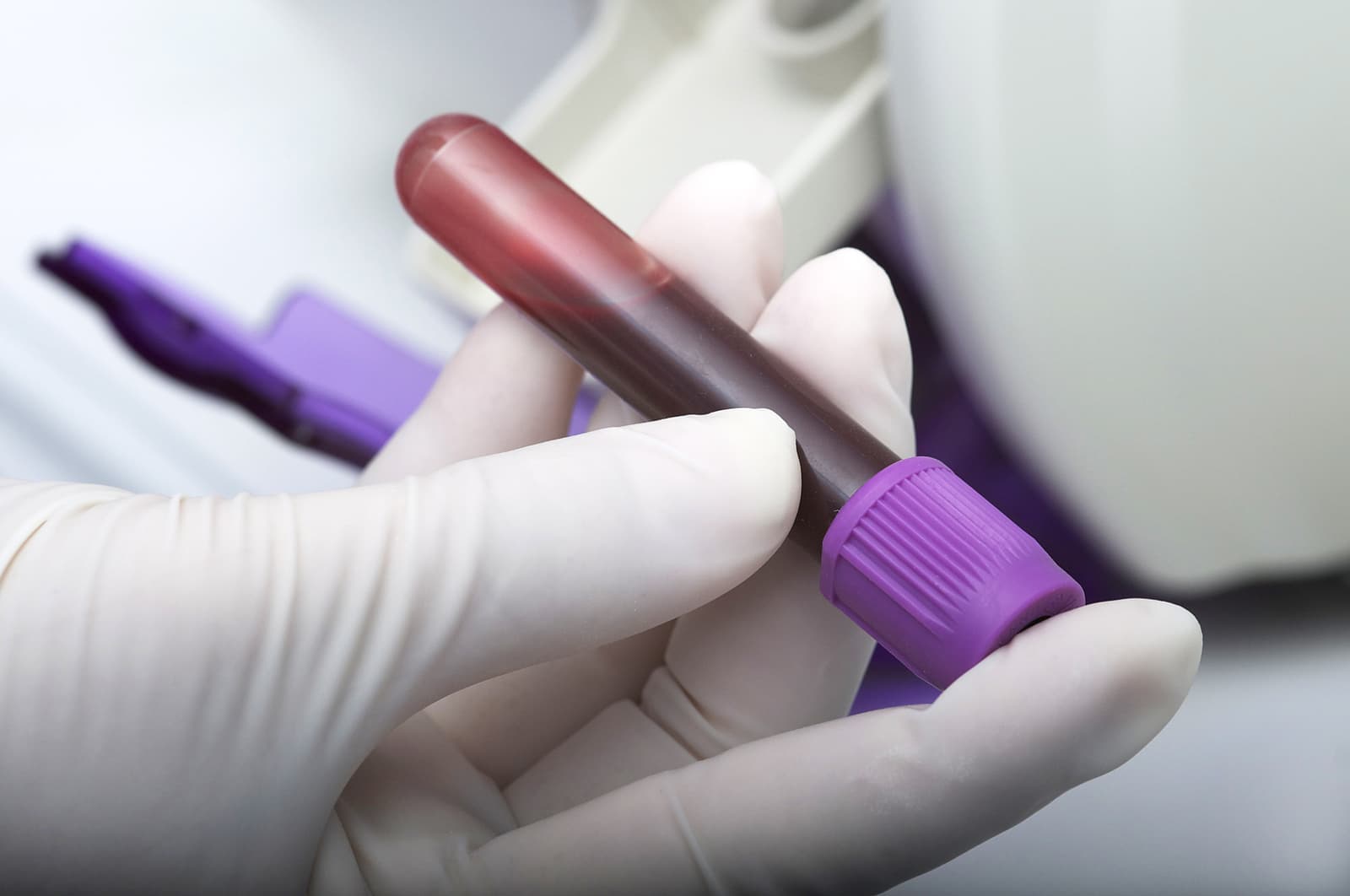How Is a Blood Test Performed?