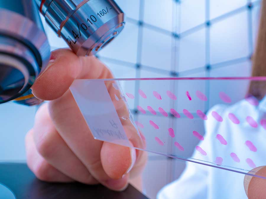 Incisional Biopsy