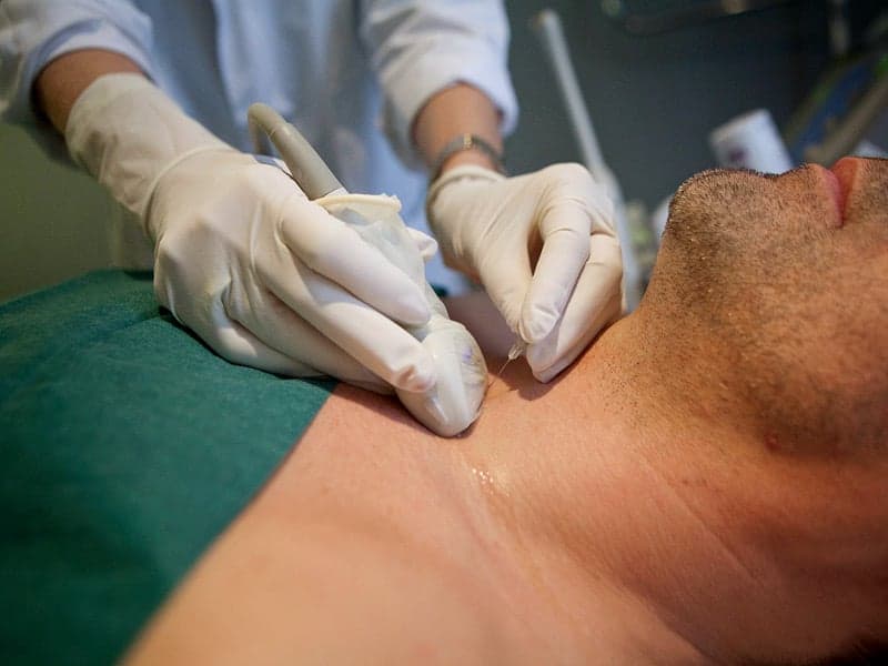 What Happens After a Biopsy?