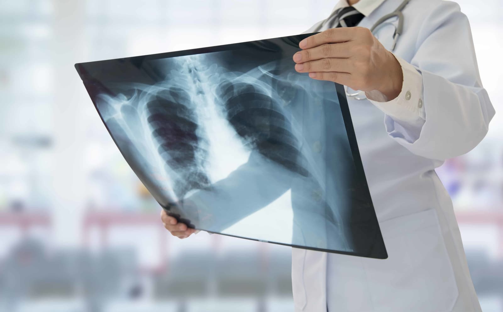 What Happens During an X-Ray?