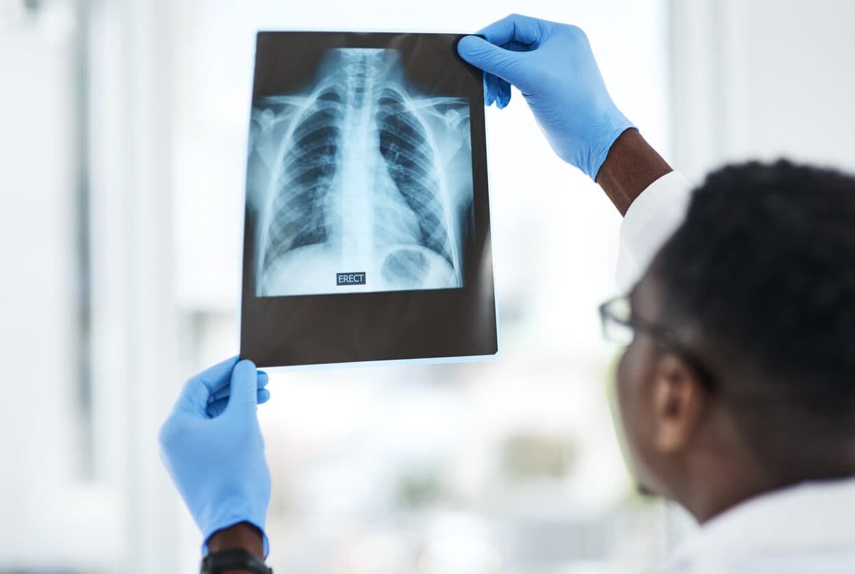 X-Ray with Contrast Material