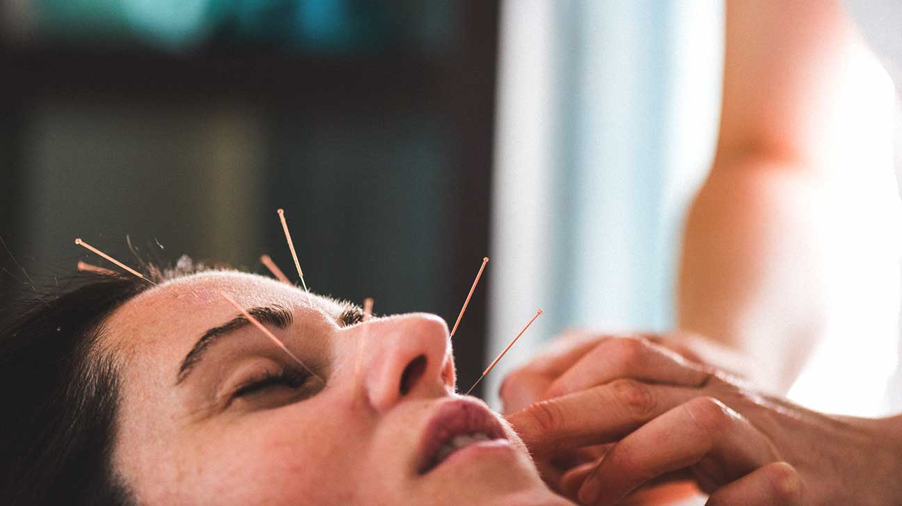 Pros of Acupuncture