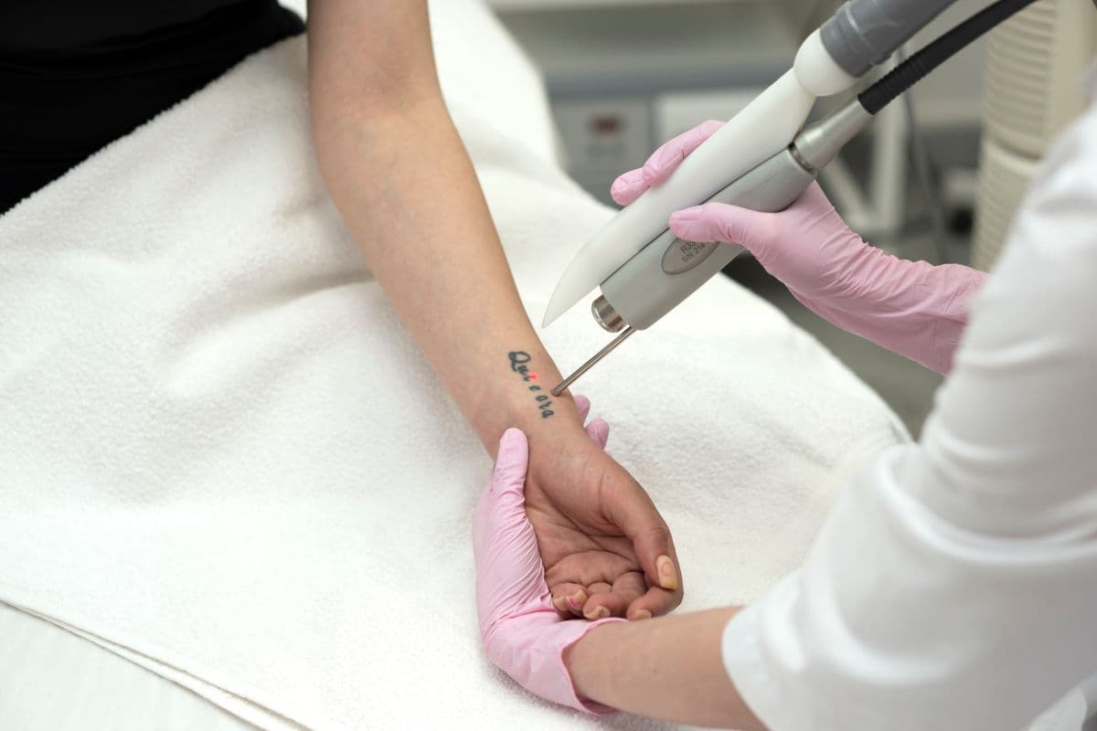 What Does Tattoo Removal Entail?