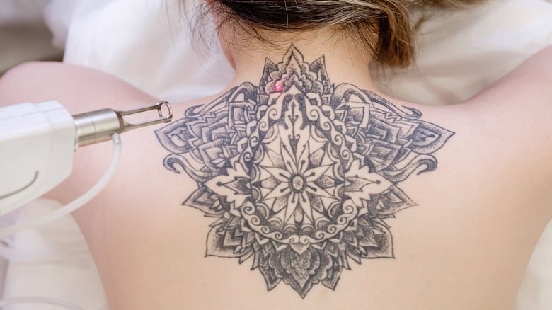Getting a tattoo vs. Tattoo removal: Which is more painful?