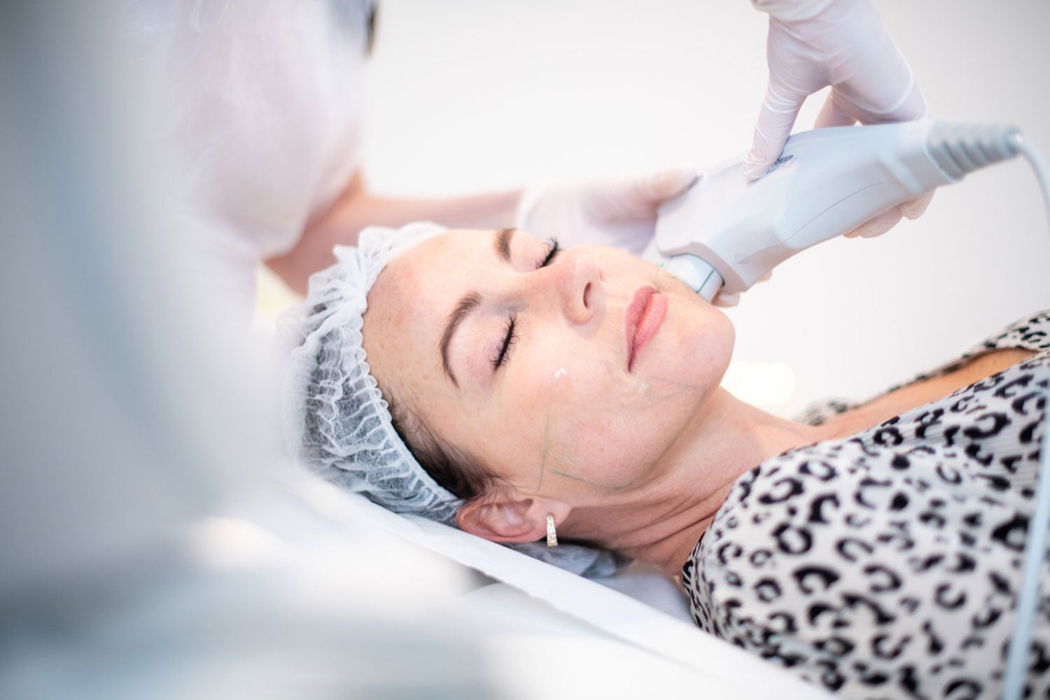 What is carboxytherapy used for?