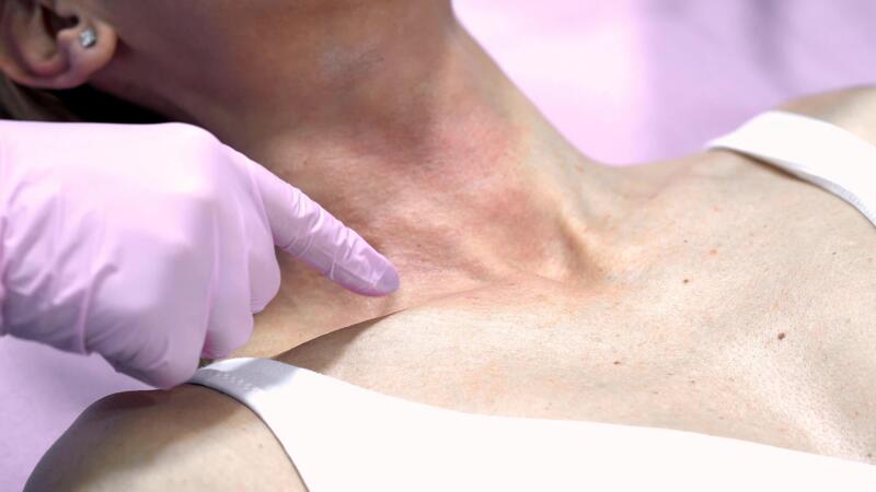 Topical Carboxytherapy for Skin Rejuvenation