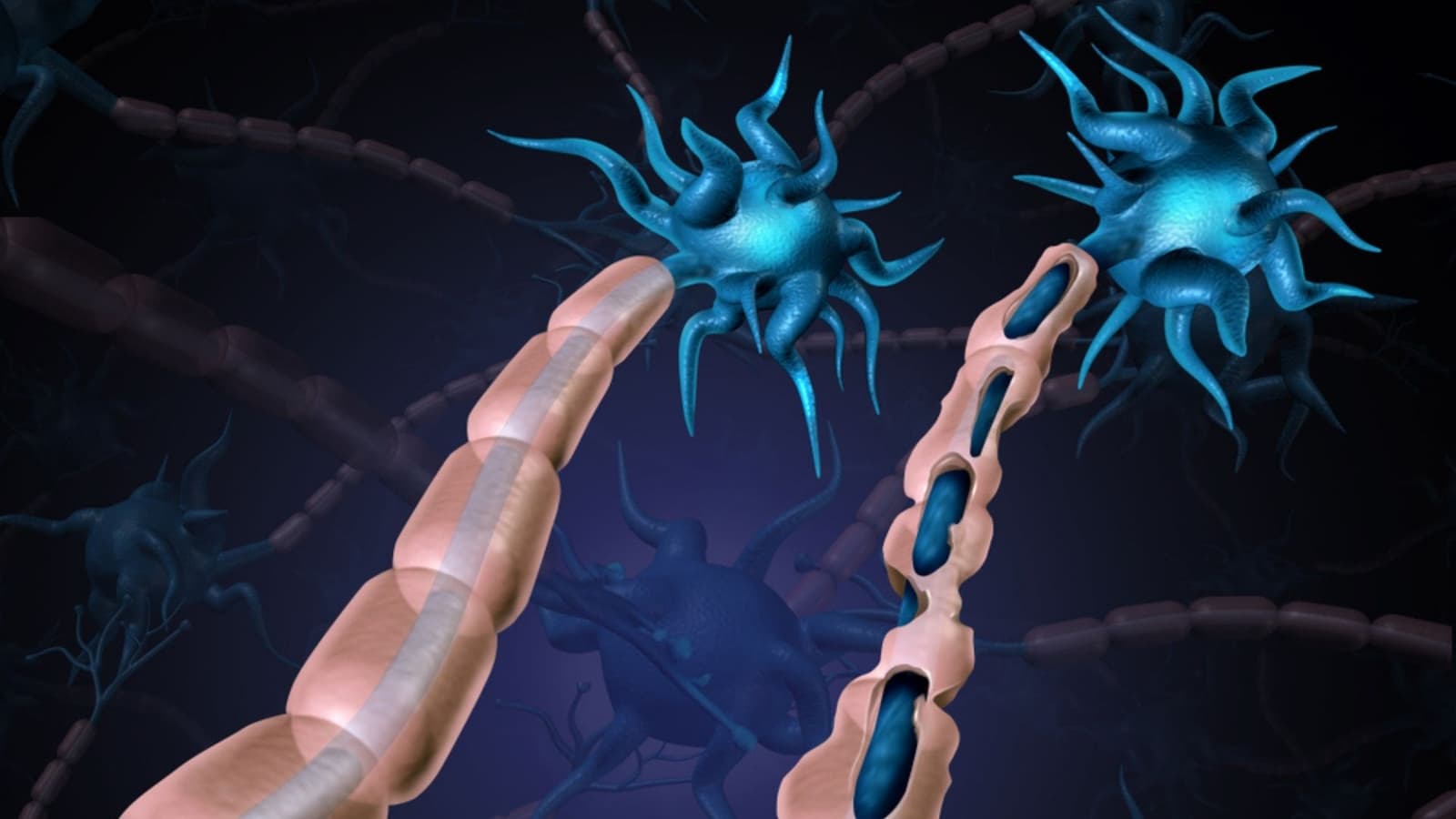 Treatment for Peripheral Nerve Damage