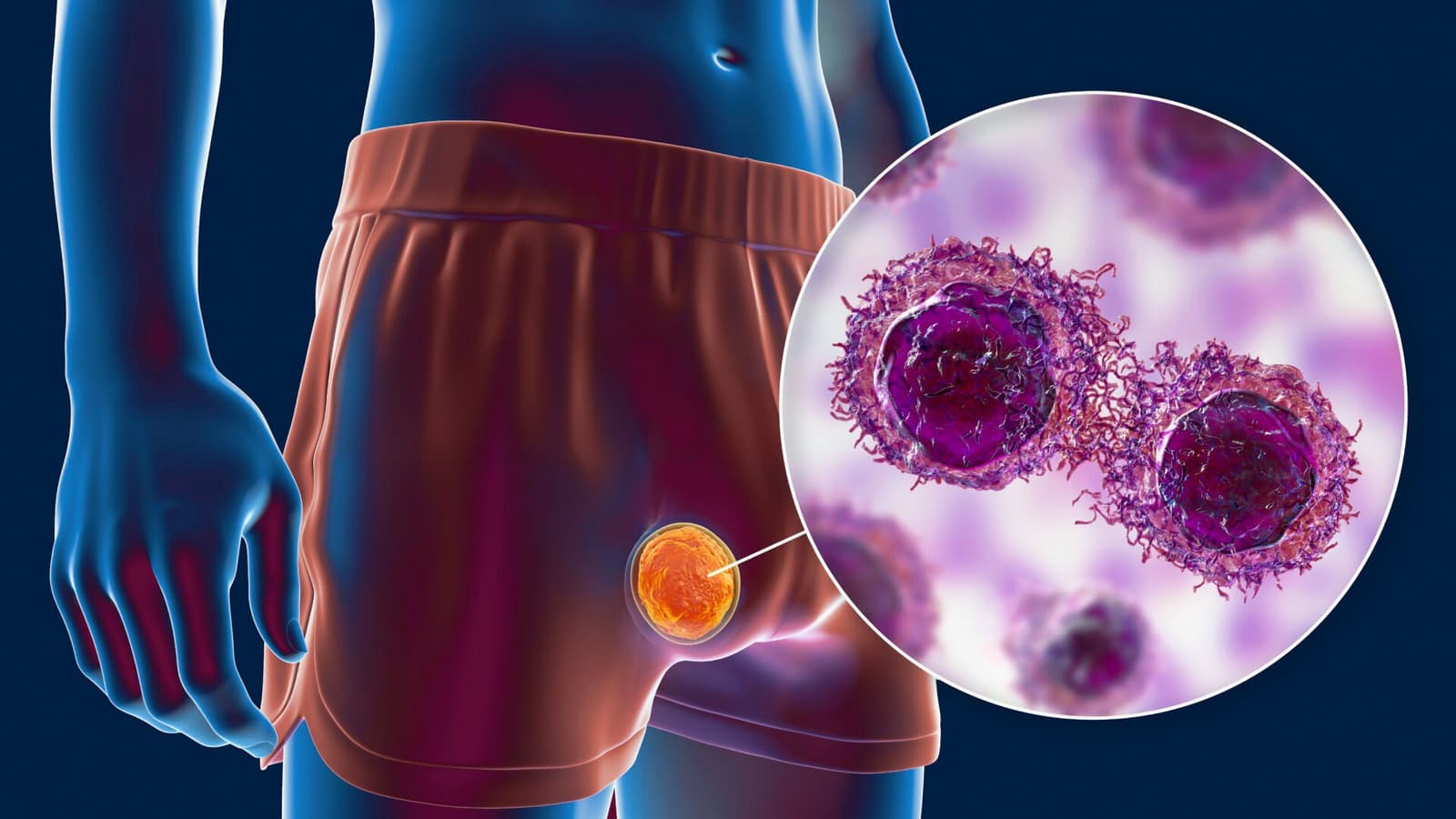 Risks and Possible Side Effects