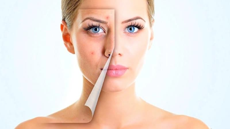 What Is Spotark Treatment?