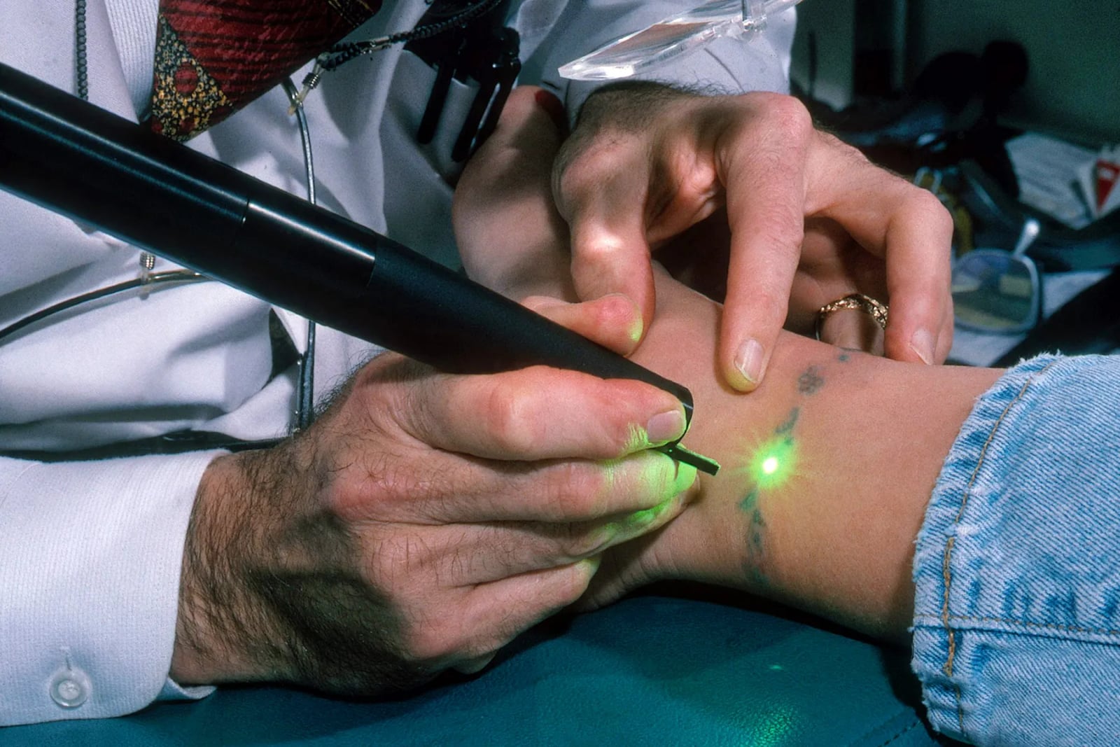 Tattoo Removal vs. Tattoo Cover-Up: Which Option Is Right for me?
