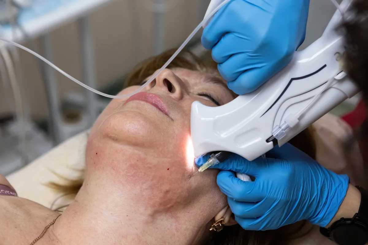 Who Should Avoid Carboxytherapy?