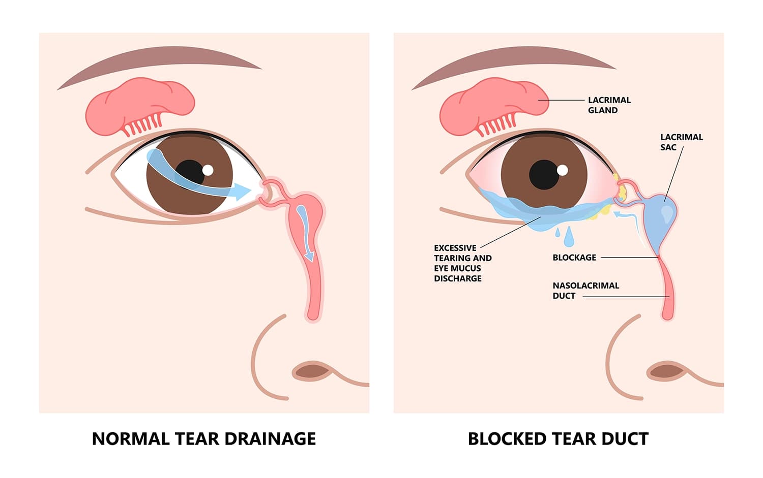 Possible Risks and Complications