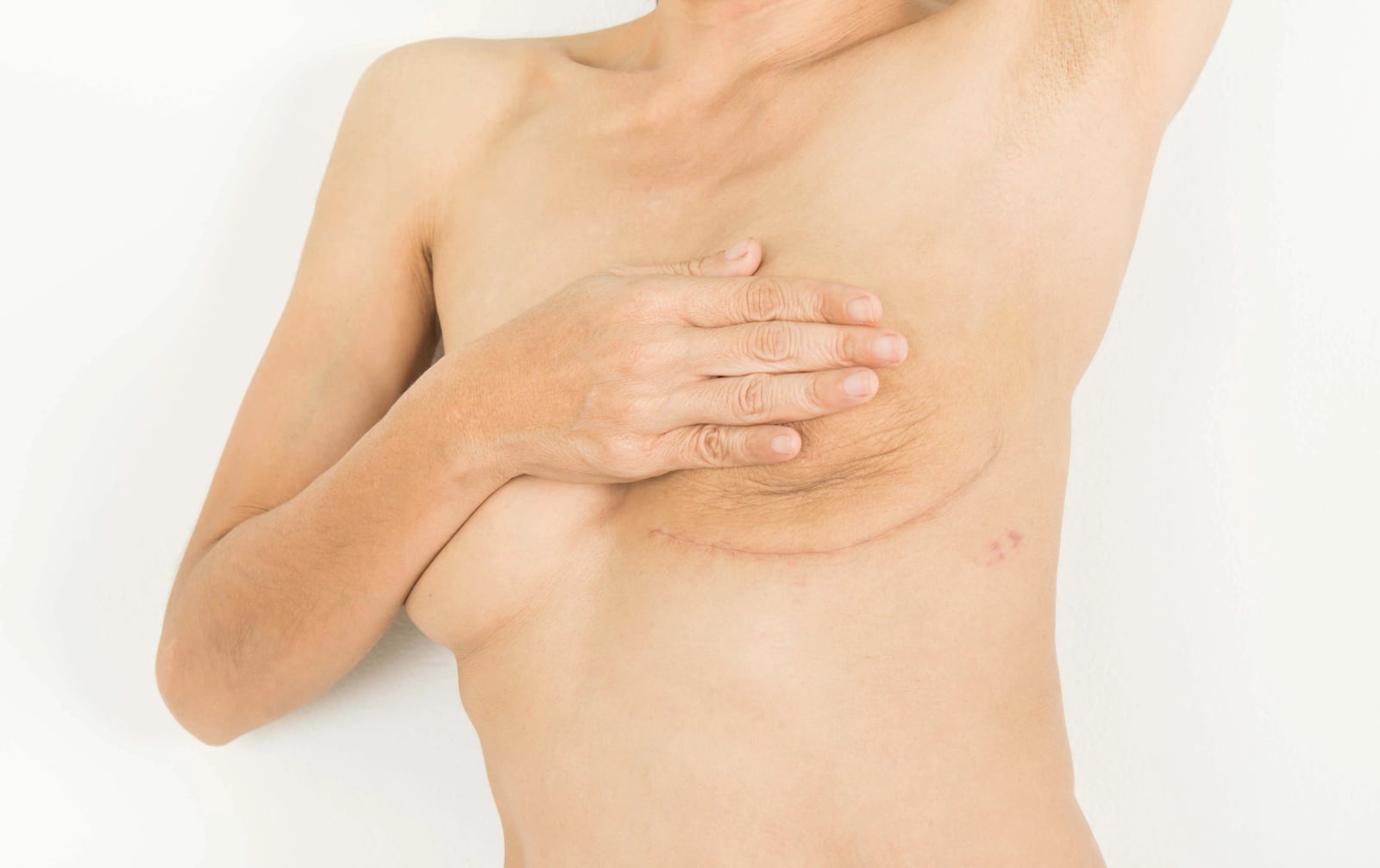 Breast Cancer & Mastectomy